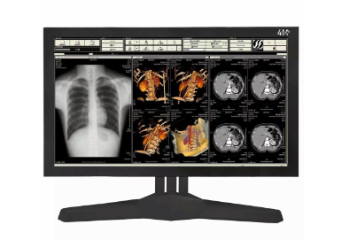 醫(yī)療顯示器幫助醫(yī)生更好地診斷疾病。