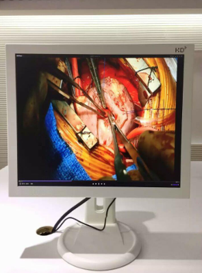 醫(yī)療顯示器：全面了解您的健康狀況